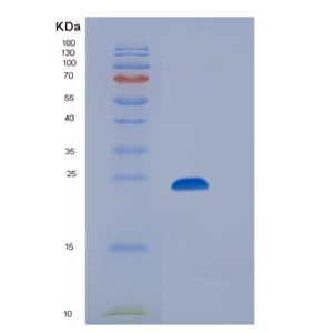 Recombinant Human CD32b / FCGR2B Protein (His & AVI tag)