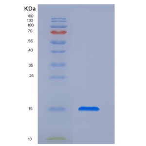 Recombinant Human CTLA4 / CD152 Protein (His tag)