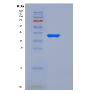 Recombinant Human ACYP2 Protein (GST Tag)