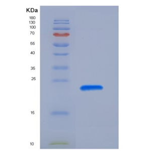 Recombinant Rat PRL2A1 / Prolactin-2A1 Protein (His Tag),Recombinant Rat PRL2A1 / Prolactin-2A1 Protein (His Tag)