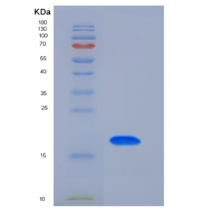 Recombinant Mouse TFPI2 / PP5 Protein (His tag),Recombinant Mouse TFPI2 / PP5 Protein (His tag)