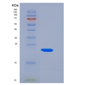 Recombinant Rat CTHRC1 Protein (His Tag),Recombinant Rat CTHRC1 Protein (His Tag)