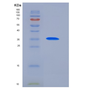 Recombinant Human PDK / PDZ binding kinase / TOPK Protein (His tag)