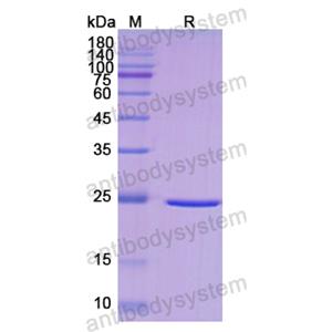 重組DLD蛋白,Recombinant Human DLD, N-His