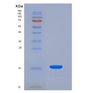 Recombinant Rat Niemann-Pick disease type C2 / NPC2 Protein (His Tag)