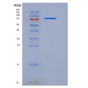 Recombinant Mouse ADAM15 / MDC15 Protein (His tag)