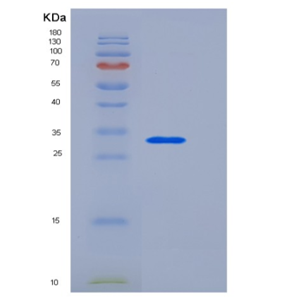 Recombinant Human Beta-amyloid 39 / Beta-APP39 Protein (aa 672-710, His & GST tag)