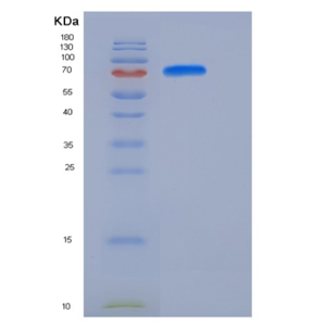 Recombinant Mouse MFI2 / CD228 / melanotransferrin Protein (His tag)