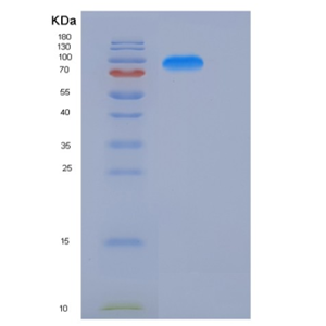 Recombinant Human KIAA1279 Protein (His & GST tag)
