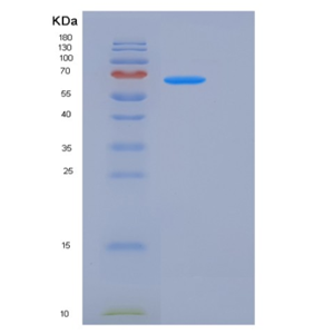 Recombinant Rat EphA3 Protein (His tag),Recombinant Rat EphA3 Protein (His tag)