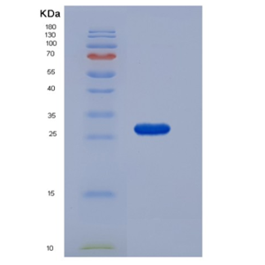 Recombinant Mouse RPE / RPE2-1 Protein (His tag)