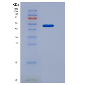 Recombinant Mouse COLEC10 Protein (Fc tag)