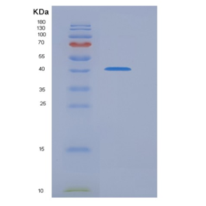 Recombinant Human ITCH / AIP4 Protein (aa 526-903),Recombinant Human ITCH / AIP4 Protein (aa 526-903)