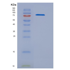 Recombinant Mouse BCAM Protein (Fc tag)