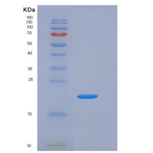 Recombinant Human H1F0 / Histone H1 Protein (His tag)