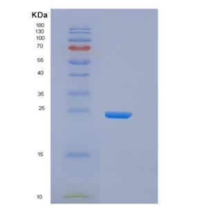 Recombinant Human CD32B Protein (His &AVI Tag), Biotinylated