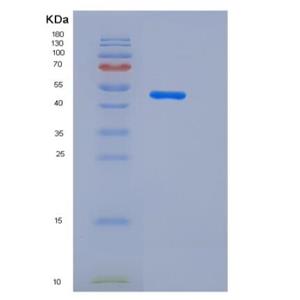 Recombinant Human HDAC4 Protein (aa 612-1084)