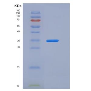 Recombinant Human Carbonic Anhydrase VB / CA5B Protein (His tag)
