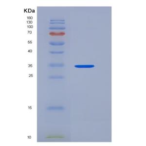 Recombinant Human IL-8 / CXCL8 Protein (aa 28-99, Fc tag)