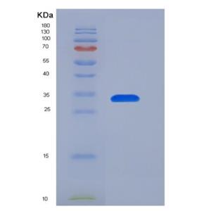 Recombinant Human IL-8 / CXCL8 Protein (aa 23-99, Fc tag)