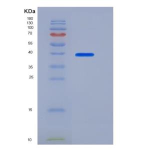 Recombinant Human / Mouse / Rat / Rhesus / Canine BMP-2 Protein (Fc Tag)
