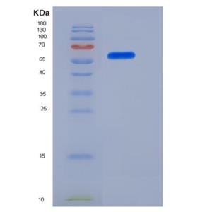 Recombinant Human IL-12 (IL12A &IL12B Heterodimer) Protein (His Tag),Recombinant Human IL-12 (IL12A &IL12B Heterodimer) Protein (His Tag)