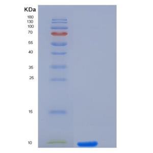 Recombinant Human IL-8 / CXCL8 Protein (aa 23-99)