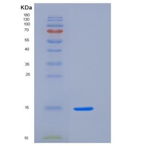 Recombinant Human BST2 Protein (His Tag)