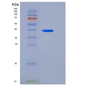 Recombinant Human TETHERIN / BST2 / CD317 Protein (Fc tag)