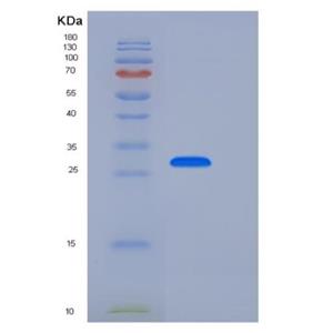 Recombinant Human CD33 / Siglec-3 Protein (His tag)