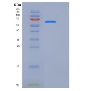 Recombinant Human CDCP1 / CD318 Protein (Fc tag)