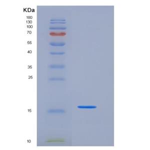 Recombinant Mouse FABP4 / ALBP / A-FABP Protein (His & MYC Tag)