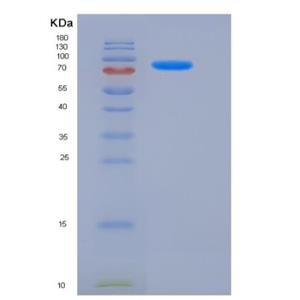 Recombinant Human PDE1B Protein (His & GST tag)