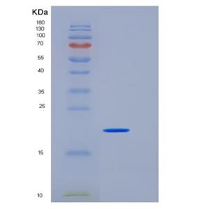 Recombinant Mouse Peroxiredoxin 1 / PRDX1 Protein (His tag),Recombinant Mouse Peroxiredoxin 1 / PRDX1 Protein (His tag)