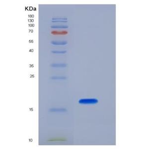 Recombinant Mouse Peroxiredoxin 5 / PRDX5 Protein (His tag)