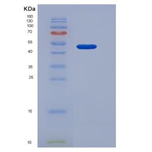 Recombinant Human CD122 / IL-2RB Protein (Fc tag)
