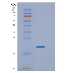 Recombinant Mouse NKG2A / NKG2 / CD159A / KLRC1 Protein (His tag)