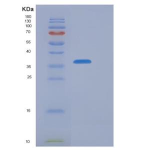 Recombinant Human CFHR1 Protein (His Tag)