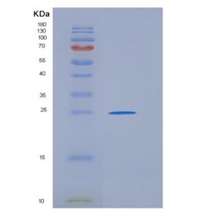 Recombinant Mouse GPA33 / Glycoprotein A33 Protein (His tag)