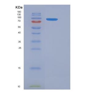 Recombinant Mouse GAD65 / GAD2 Protein (His & GST tag)