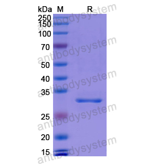 重組C1S蛋白,Recombinant Human C1S, N-His