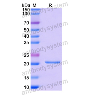 重组CSF3/G-CSF蛋白,Recombinant Human CSF3/G-CSF, N-His