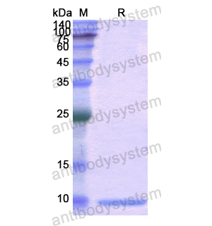 重組UBB蛋白,Recombinant Human UBB, N-His