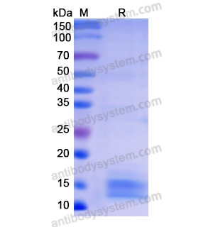 重組SAA2蛋白,Recombinant Human SAA2, N-His