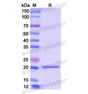 重組CSH1蛋白,Recombinant Human CSH1, N-His