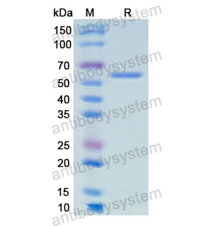 重组AMY1A蛋白,Recombinant Human AMY1A, N-His