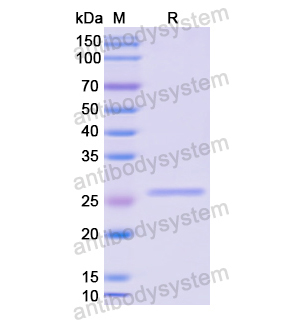 重组GLI3蛋白,Recombinant Human GLI3, N-His