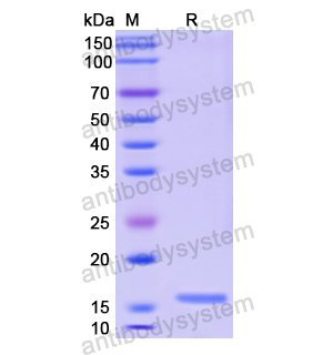 重組CALCB蛋白,Recombinant Human CALCB, N-His