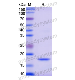 重组RNASE2蛋白,Recombinant Human RNASE2, N-His