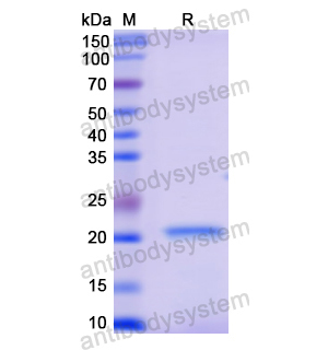 重组GAA蛋白,Recombinant Human GAA, N-His